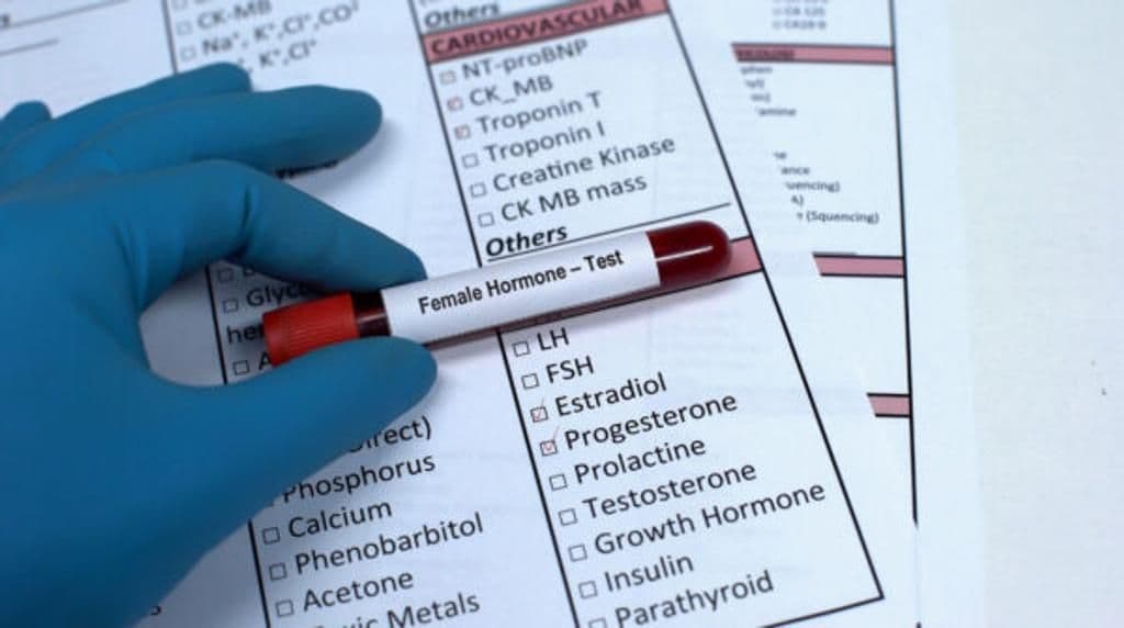 Female-hormone-test
