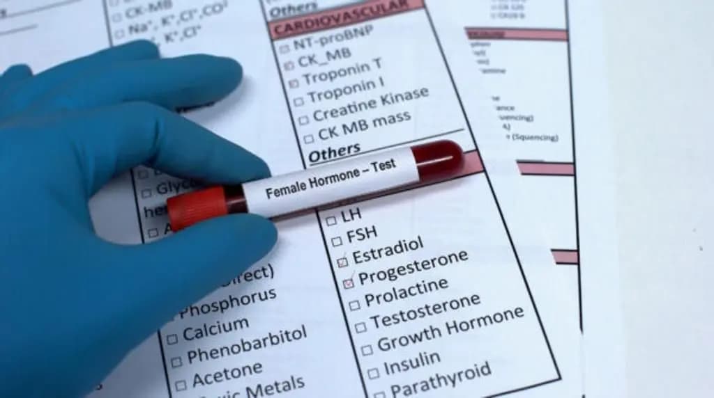Female-hormone-test